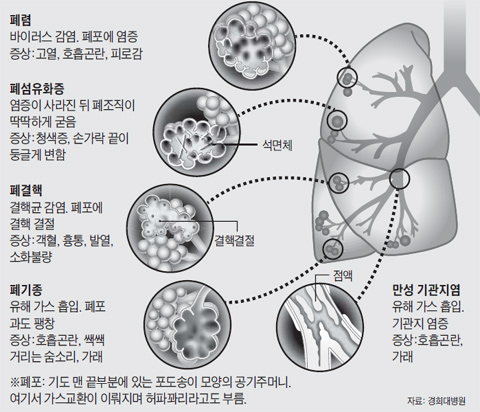 ���� ��ħ �����ϴ� ȣ���� ��ȯ.